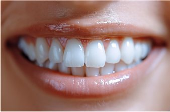 Best Dentist in Andheri West